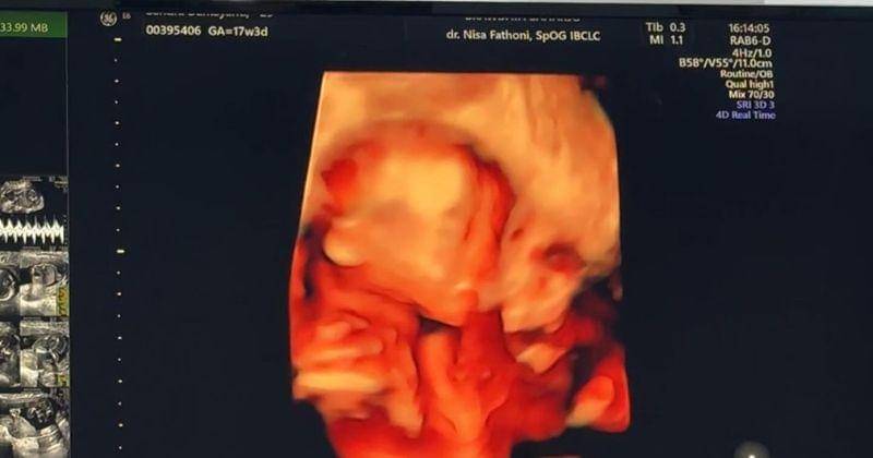 Instagram.com/sandradlubis